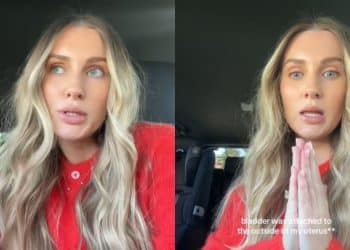 Mulher descobre que seu embrião estava dentro da cicatriz de sua cesárea anterior; entenda a condição rara