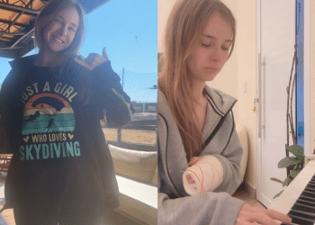 Sem plano de saúde, Sammy Sampaio revela gasto alto após cirurgia na mão