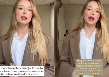 Duda Reis faz cirurgia plástica após ganhar 27 kg na gravidez: “Estava muito insegura”