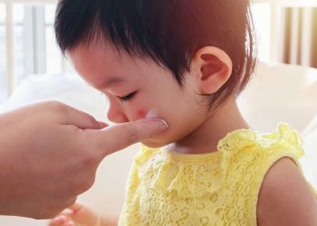 Picada de mosquito, formiga ou abelha em bebê? Saiba como agir com segurança