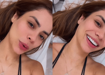 Lexa faz tratamento para clarear cicatriz de cesárea após a perda da filha Sofia