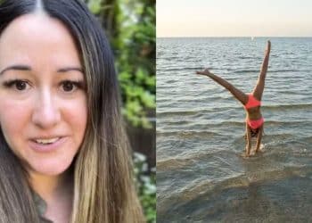 Mulher que perdeu a visão por dar ‘estrelinha’ na praia quando jovem continua com sequelas após 20 anos