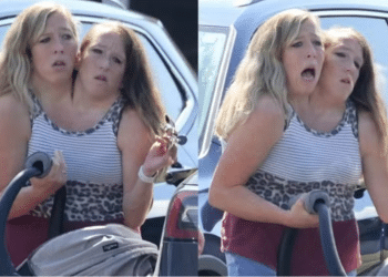 Famosas gêmeas siamesas são vistas com bebê: podem engravidar?