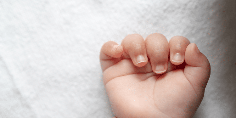 Os principais sinais da dermatite atópica para ficar de olho. Foto: Freepik