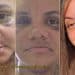 Mulher que foi agredida com 60 socos por ex-namorado mostra evolução da recuperação de cirurgia