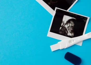 Ultrassom e teste positivo de gravidez em um fundo azul.