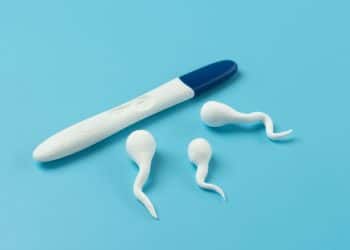 Teste de gravidez e espermatozoides representando a retirada do DIU.