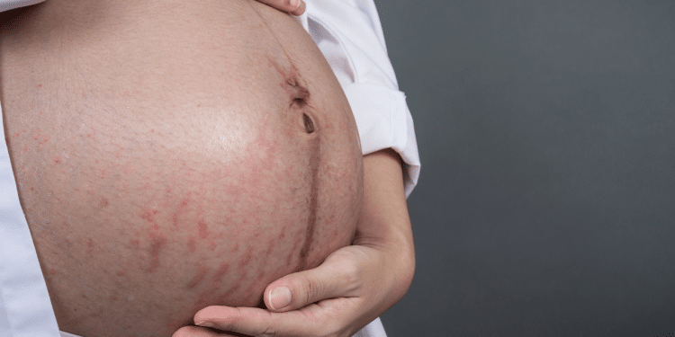 Barriga de mulher grávida