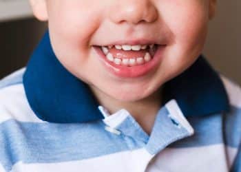 Bebê com dentes nascendo.