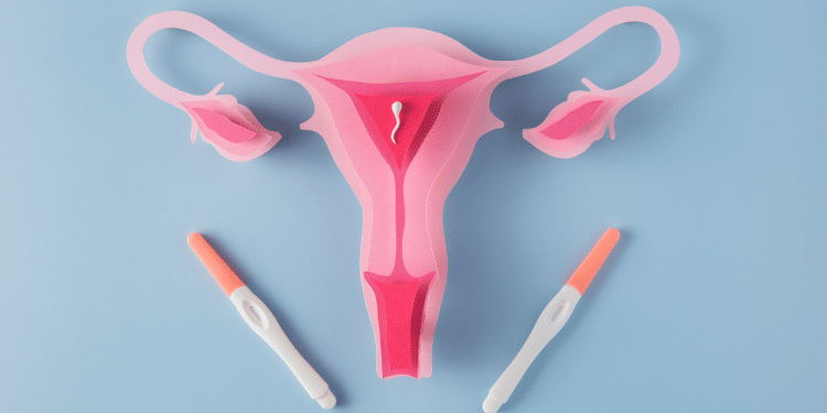 É possível engravidar usando DIU Conheça riscos e sinais que você não pode ignorar.