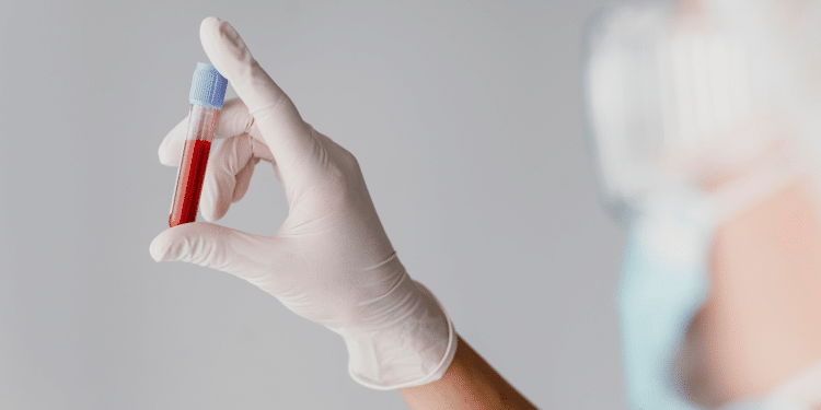 O exame de sangue pode prever um parto prematuro? Pesquisa inovadora diz que sim.